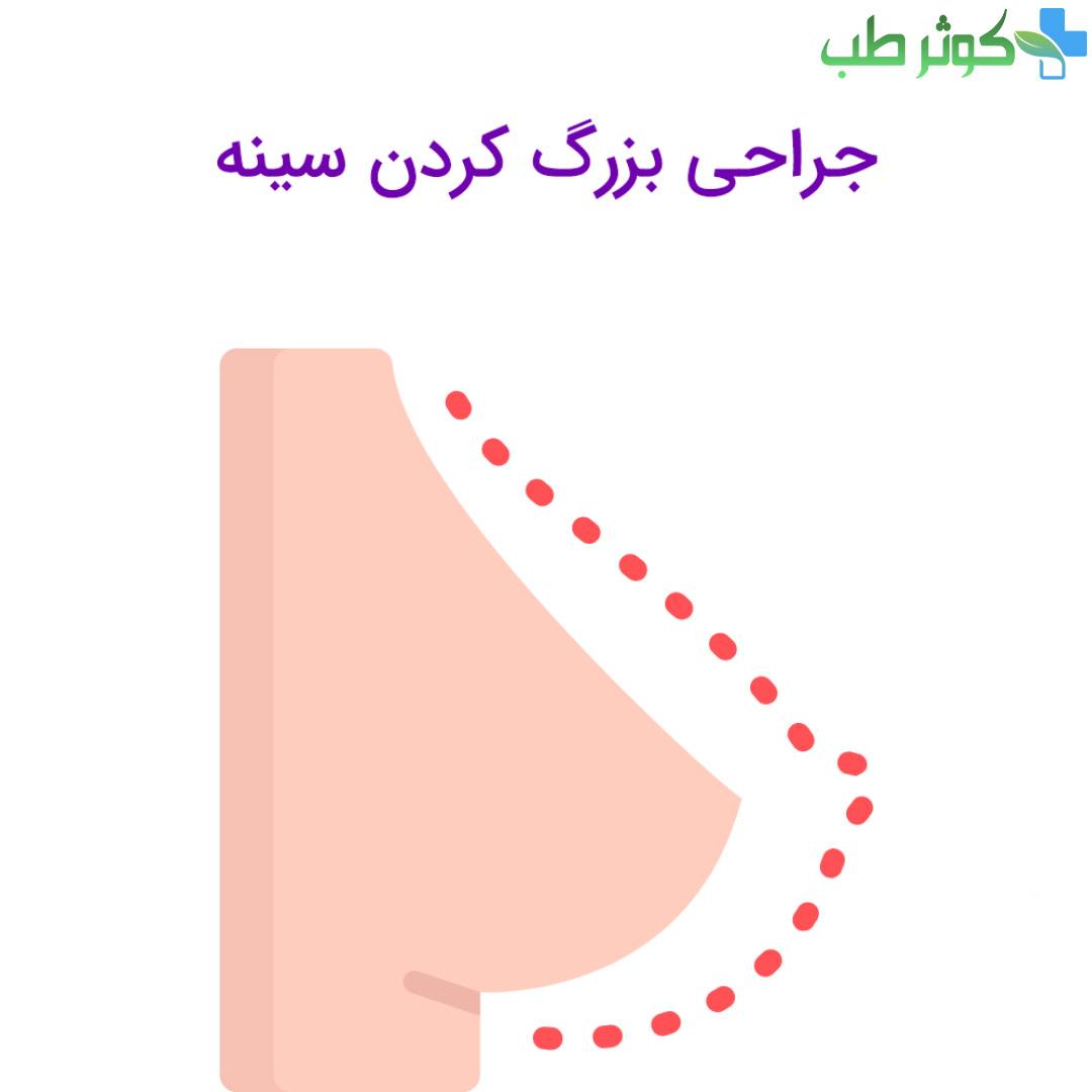 درمان افتادگی سینه زنان